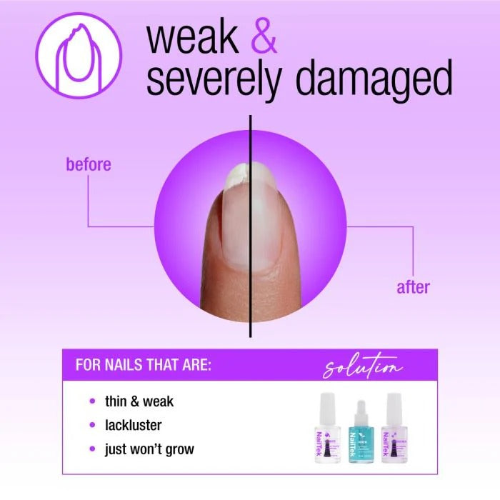Hệ thống Cứu hộ Móng Nail Tek